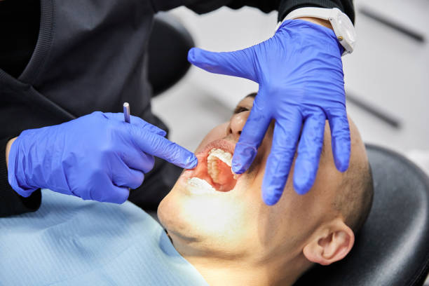 Best Broken or Chipped Tooth Repair in Holladay, UT